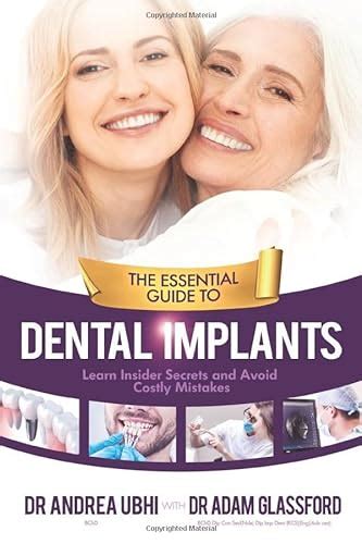 The Essential Guide To Dental Implants Learn Insider Secrets And Avoid