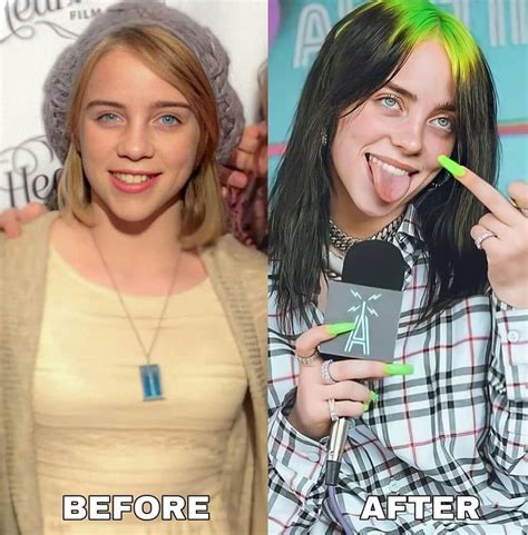 Billie Eilish Before And After 4k Hd Wallpaper
