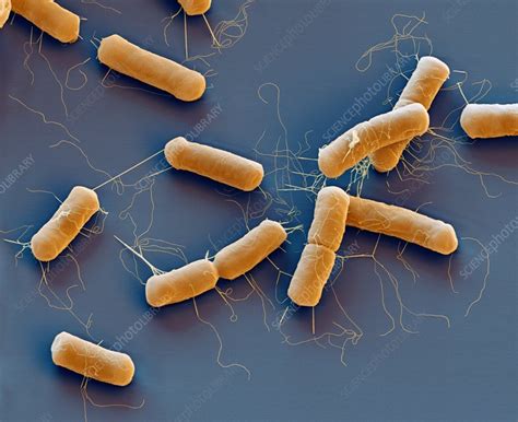 Bacillus Cereus Bacteria Sem Stock Image C0090415 Science Photo