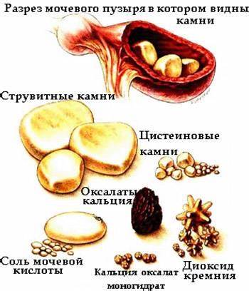 Мочекаменная болезнь у собак: симптомы, лечение, лечебная диета Картинка - Мочекаменная болезнь у собак: симптомы, лечение, лечебная диета