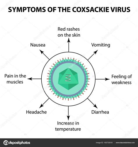 Symptoms Of Infection Coxsackie Virus Enterovirus Infographics Vector Illustration On