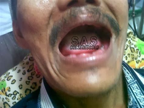 We did not find results for: S.A.S - AHLI GIGI KOTA PATI, Jateng & KOTA JEMBER, Jatim ...