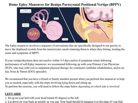 Epley Maneuver Patient Handout For BPPV Etsy