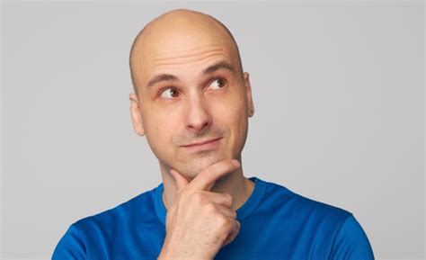 Can bald people get dandruff?