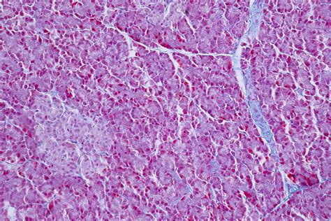 Human Liver Tissue Light Micrograph Stock Image F0324121