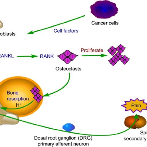 Bone Cancer Diagram