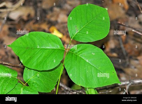 Poison Ivy Rash Hi Res Stock Photography And Images Alamy