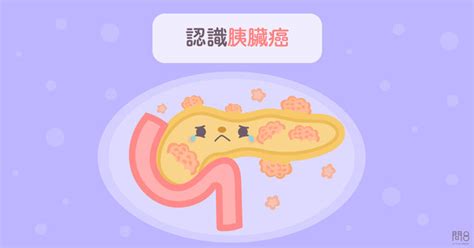 Jul 03, 2021 · 香港女星羅慧娟過去跟「星爺」周星馳有一段情，被視為周星馳心中最大遺憾，但她本人則將這段過去當做黑歷史，打死也不承認兩人交往過。羅慧娟2008年嫁給新加坡股票大亨劉志敏，2012年6月30日因罹患胰臟癌病逝，享年46歲。自此劉志敏年年都會登報哀悼愛妻，今年他寫下「劉羅慧娟，九年了. 周則中醫師／難發現、預後差的「胰臟癌」 並不是完全束手無策 | ETtoday探索 | ETtoday新聞雲