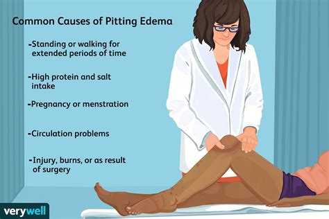 Pitting Edema Grading When Swelling Becomes Serious