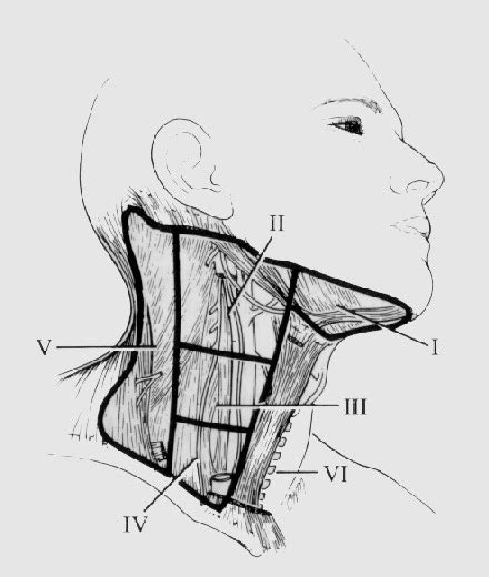 List 95 Pictures Pictures Of Lymph Nodes In Neck Sharp