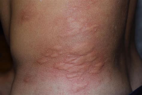 Medical Dermatology Skin Conditions We Treat