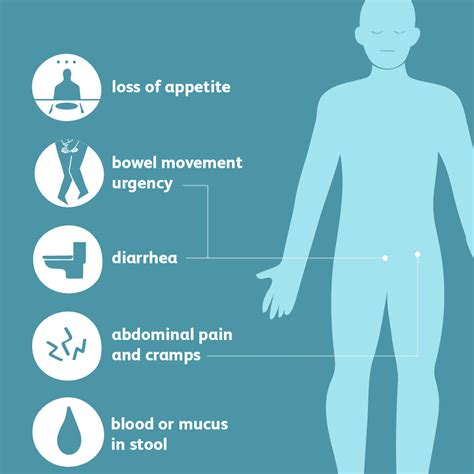 Ulcerative Colitis Signs Symptoms And Complications