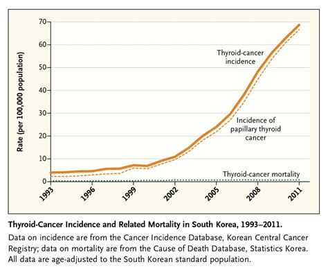 The Case Against Early Cancer Detection Fivethirtyeight