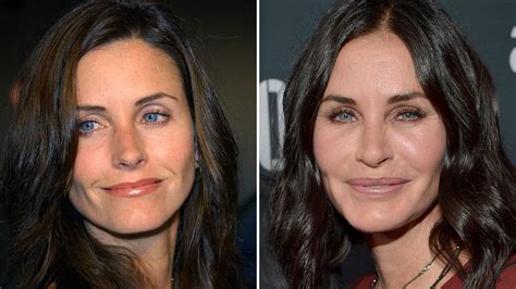 Courtney Cox plastic surgery before and after - Plastic ...