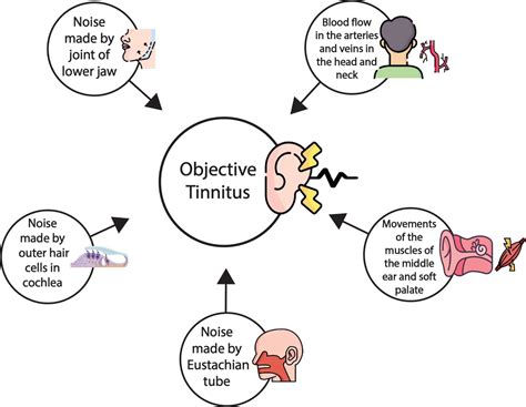 Tinnitus Causes Therapies And Solutions Hashir Tinnitus Clinic