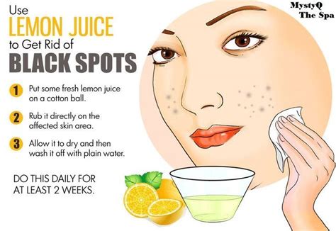 How To Remove Dark Spots On Face And Body Howtoremvo