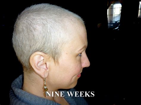 Chemo After Chemo Hair