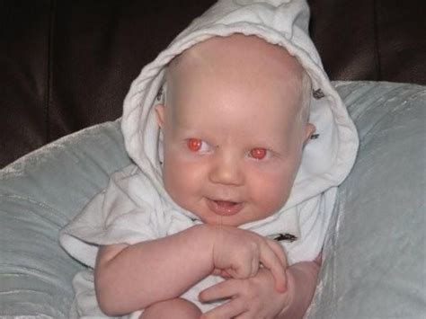 Люди Альбиносы С Красными Глазами Настоящие Фото Telegraph