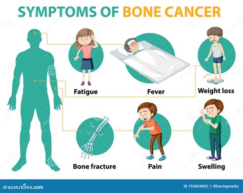 Medical Infographic Of Bone Cancer Symptoms Stock Vector Illustration