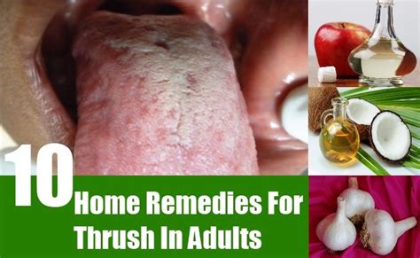 Pin On Home Remedies