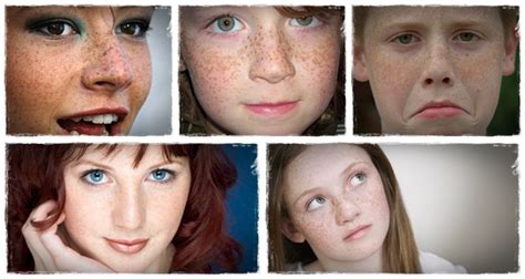 Lemon juice for freckles lemon has lightening properties that help in bleaching the dark spots in a very short time period. Learn 11 Useful Tips On How To Remove Freckles - V-kool