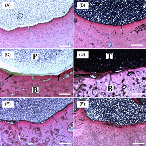 Typical Scanning Electron Microscope Images Around The Bonecement