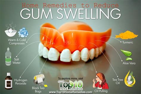 Home Remedies To Reduce Gum Swelling Top 10 Home Remedies