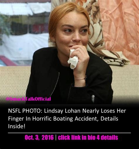 Nsfl Photo Lindsay Lohan Nearly Loses Her Finger In Horrific Boating