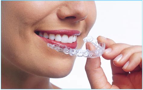 Clear Aligner Invisible Braces Aesthetic Dental Zone