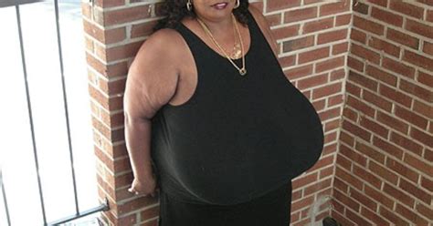 Largest Breasts In The World Record Set By Norma Stitz World Amazing Records Ouch Fun