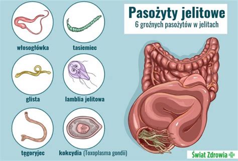 Jak Sprawdzi Czy Mam Paso Yty Naturalny Spos B Na Odrobaczanie Abie Sekrety