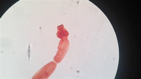 Echinococcus Granulosus Youtube