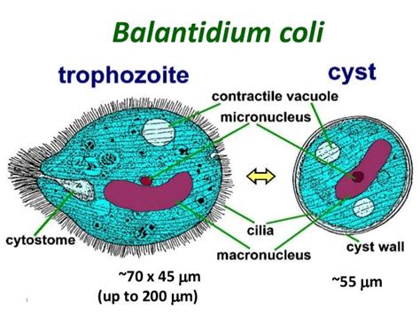 Balantidium Coli Causes Balantidiasis Or Balantidial Dysentery It Is A