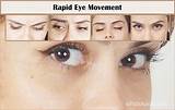 Images of Rapid Eye Therapy Training