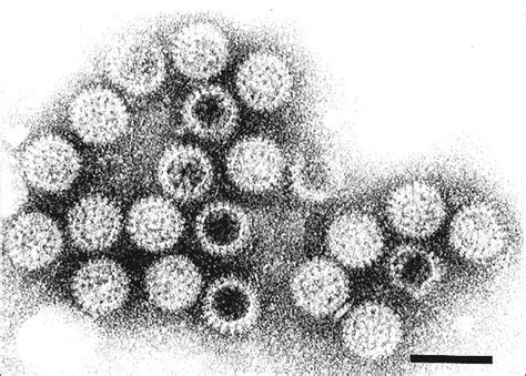 Figure 1 - Rotavirus - Volume 4, Number 4—December 1998 - Emerging