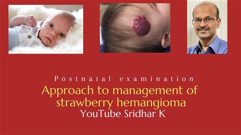 Approach To Management Of Strawberry Hemangioma Dr Sridhar K Youtube