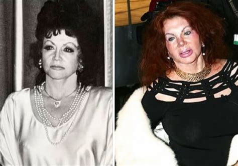 Jacqueline Stallone Before And After Plastic Surgery
