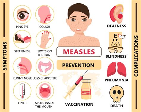 Measles Infographic Concept Vector Infected Boy With Papules On The