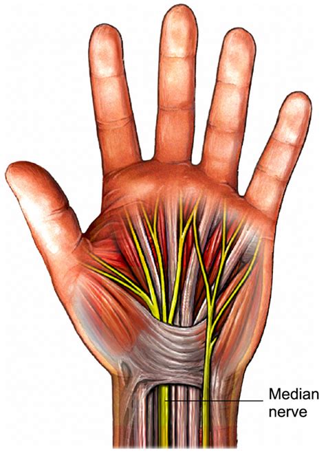 Carpal Tunnel Syndrome Lothian Virtual Hand Clinic