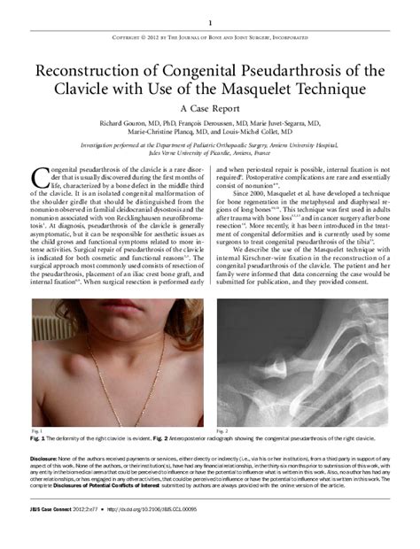 Pdf Reconstruction Of Congenital Pseudarthrosis Of The Clavicle With