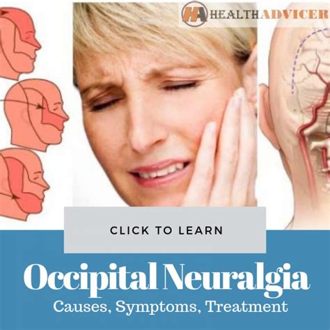 Occipital Neuralgia Images