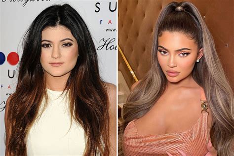 What Did Kylie Jenner Look Like Before And After Lip Filler The Sun