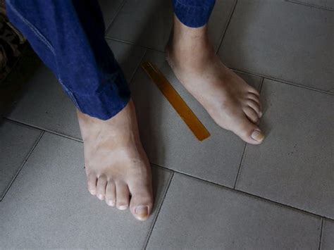 Worlds Biggest Feet Record Broken