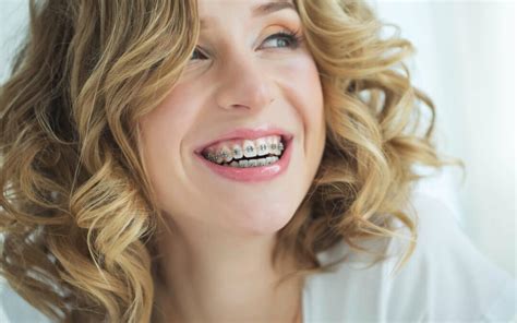 What To Expect When Getting Braces As An Adult Creekside Orthodontics