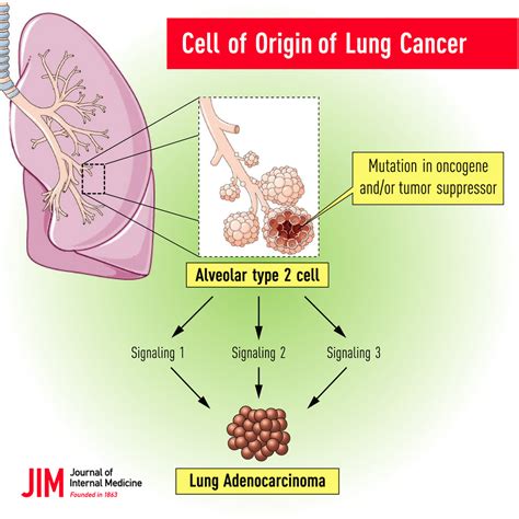 Lung Cancer Origen Cell
