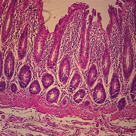 Glandular Epithelium Tissue