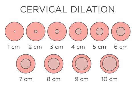 cervix dilation chart signs stages and procedure to check