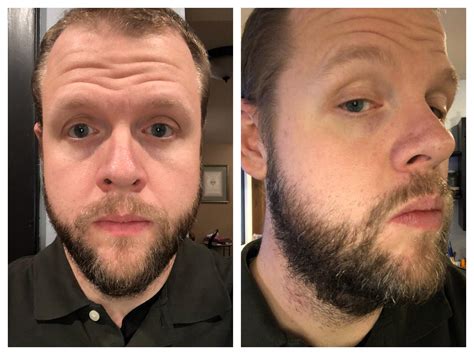 You just look at what length. Kept a short beard (#2 guard on the clippers) for about a ...