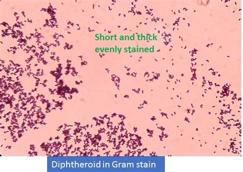Diphtheroids In Gram Stain Introduction List Of Diphtheroids And Their