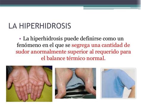 Hiperhidrosis
